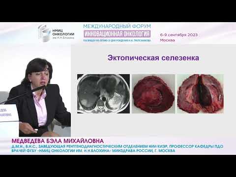 Видео: Ранний рак печени: что это такое и как его выявить?_Кудашкин Н.Е.