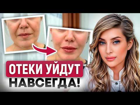 Видео: Ваши ОТЕКИ КРИЧАТ об ЭТОМ, срочно смотрите! / ОПАСНЫЕ причины отеков и как БЫСТРО разогнать лимфу?