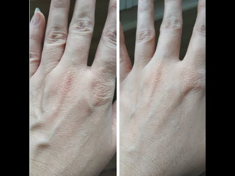 Видео: МАСКА ЗОЛУШКИ ДЛЯ РУК: минус 5 лет за 30 минут!