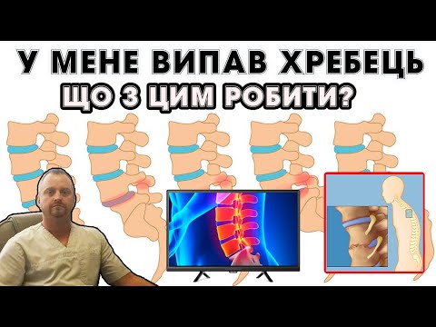 Видео: Зміщення хребців: що це і як відновлювати здоров'я. Лістез - зміщення хребців - симптоми, лікування