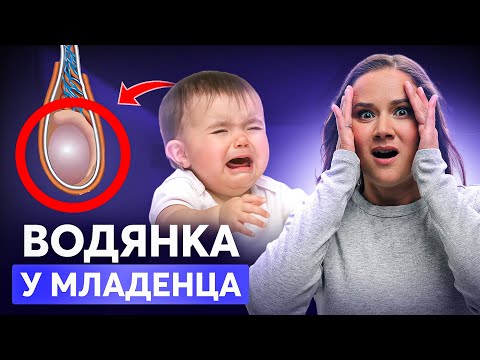 Видео: ВОДЯНКА У НОВОРОЖДЁННОГО: КРАСНЫЕ ФЛАЖКИ, КОТОРЫЕ НЕЛЬЗЯ ИГНОРИРОВАТЬ!