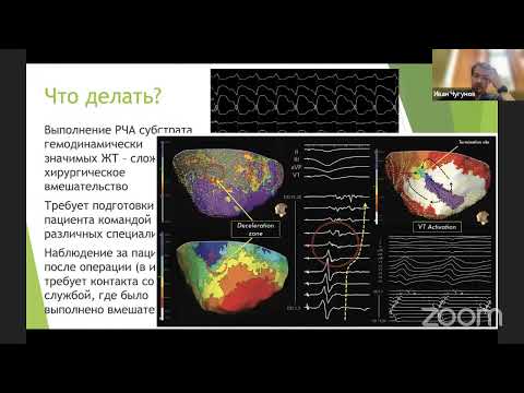 Видео: Носимые ЭКГ-регистраторы у нас в кармане: теперь все проще