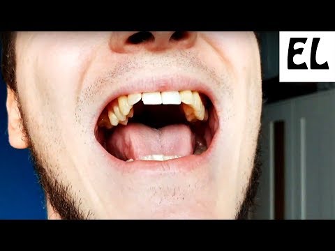 Видео: КАК НАУЧИТЬСЯ НЕ КАРТАВИТЬ И ВЫГОВАРИВАТЬ БУКВУ Р ✔ Смотри и учись!