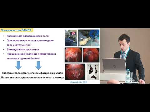 Видео: Медиастиноскопия: от диагностики до лимфодиссекции