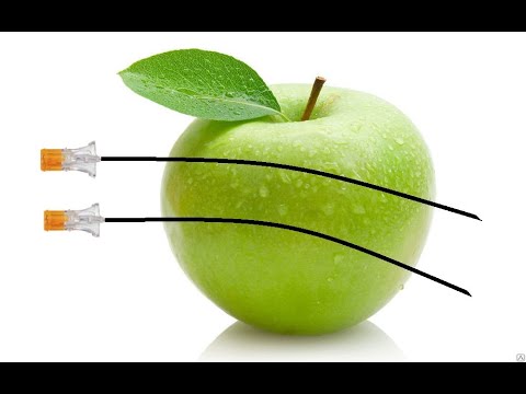 Видео: Нюансы спинномозговой анестезии