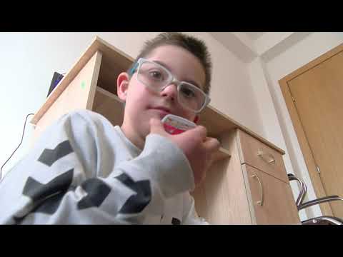 Видео: Даунов синдром по дефиниција е еден хромозом повеќе, во пракса е илјадници емоции повеќе!