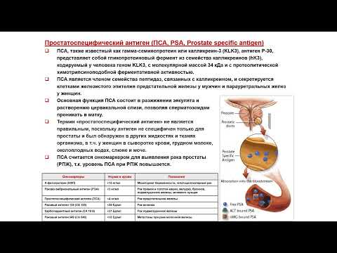 Видео: УЗИ. Доктор Иогансен. Выпуск 118.  Доброкачественная гиперплазия предстательной железы. Часть 4.