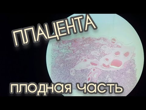 Видео: ПЛАЦЕНТА ПЛОДНАЯ ЧАСТЬ