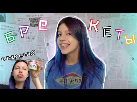 Видео: НЕДЕЛЯ С БРЕКЕТАМИ | ответы на ваши вопросы