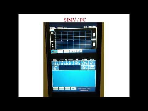 Видео: Искусственная вентиляция лёгких (2 часть)