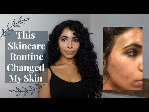 Видео: Мой антивозрастной уход за кожей с третиноином для 20-летних | Комбинированная кожа, склонная к акне