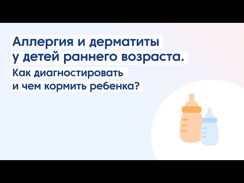Видео: Аллергия и #дерматиты у детей раннего возраста. Как диагностировать и чем кормить ребенка?