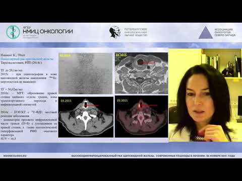 Видео: Радиоизотопная диагностика РЩЖ