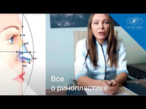 Видео: Все о ринопластике - закрытая ринопластика, подготовка, реабилитация. Хирург Сафонова Л.Н.