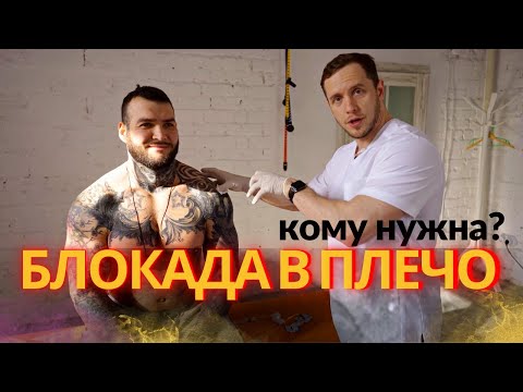 Видео: БЛОКАДА в плечо | Сколько стоит | Кому нужна и не нужна?