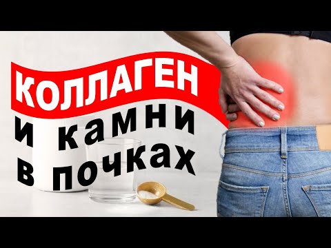 Видео: Опасность коллагена для почек. Почему вам нужно беспокоиться?