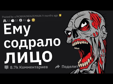 Видео: Врачи, В Каком Наихудшем Состоянии к Вам Поступил Пациент?