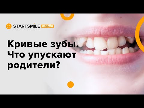 Видео: Кривые зубы у детей | Лечение и последствия