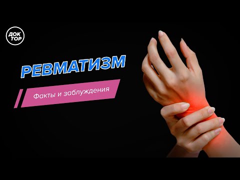 Видео: Ревматизм. Факты и заблуждения.