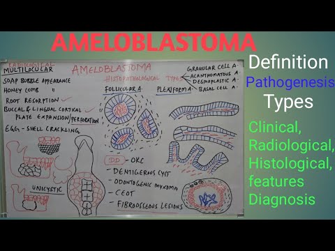 Видео: Амелобластома — определение, патогенез, типы, клинические и рентгенологические признаки, диагностика