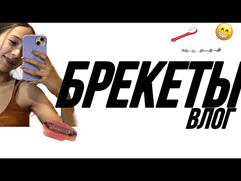Видео: МНЕ ПОСТАВИЛИ БРЕКЕТЫ| установка, влог, обзоры, реакции друзей🫶🏼