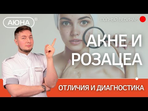 Видео: Акне или розацеа? Отличия и диагностика