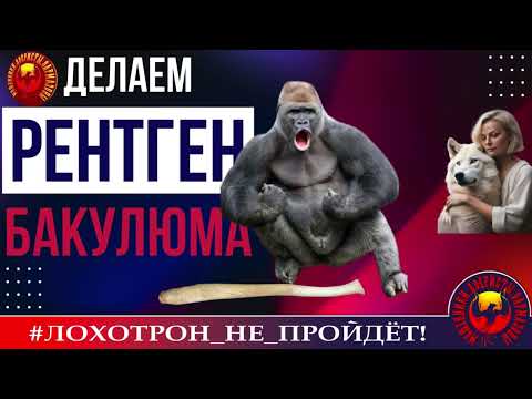 Видео: 🔥✅ДЕЛАЕМ РЕНТГЕН БАКУЛЮМА. (АВТОР - Prima). МОШЕННИКИ, АФЕРИСТЫ.