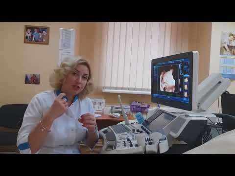 Видео: Определение пола плода на УЗИ.  Inside Pregnancy: Girl or Boy? Baby Ultrasound and Gender Reveal