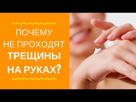 Видео: Трещины на руках и экзема! ✋ Почему не проходит?