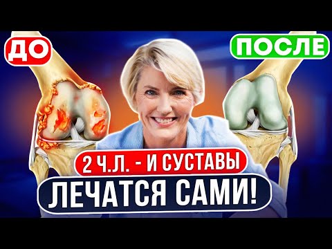 Видео: Ортопед: Удивительно быстрый эффект!ВОТ, что избавит от боли в суставах на 15 лет! От артрита,артоза