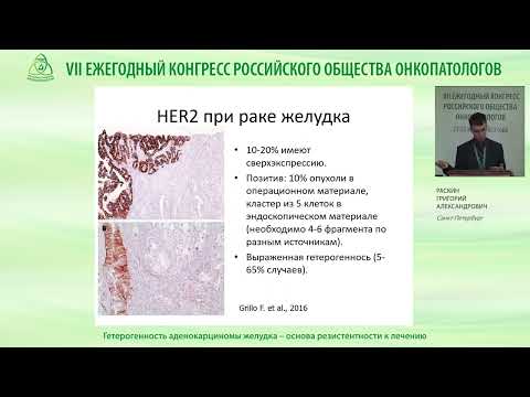 Видео: Гетерогенность аденокарциномы желудка – основа резистентности к лечению