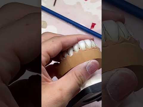 Видео: Зубной техник dental technician обработка керамики técnico dental Zahntechniker فني أسنان Noritake