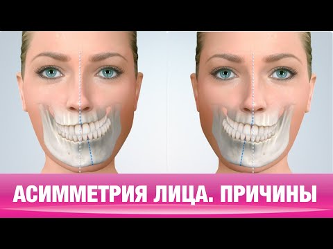 Видео: ОТКУДА БЕРЁТСЯ АСИММЕТРИЯ ЛИЦА.