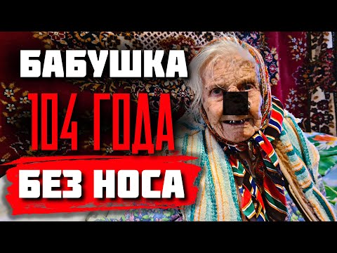 Видео: Почему бабушка в 104 года осталась без носа?