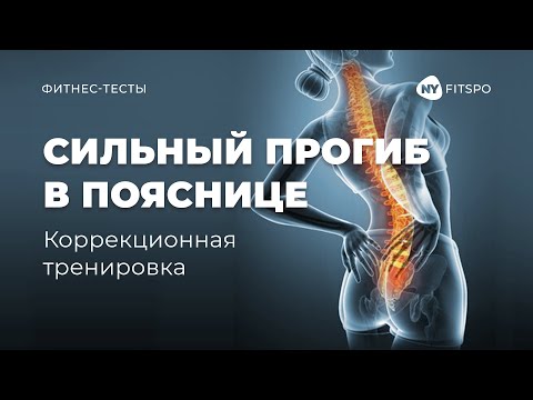 Видео: Исправляем осанку | КОМПЛЕКС УПРАЖНЕНИЙ при ГИПЕРЛОРДОЗЕ| Тест на гиперлордоз в домашних условиях