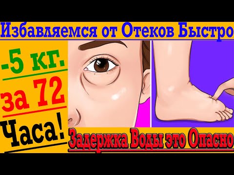 Видео: Как Избавиться от Отёков и Задержки Воды в Организме!