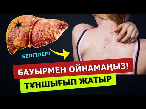 Видео: Бауырыңыздың өліп жатқанының  белгілері. Бауыр проблемалары бар 90% адам тіпті білмейді. Бауыр ауруы