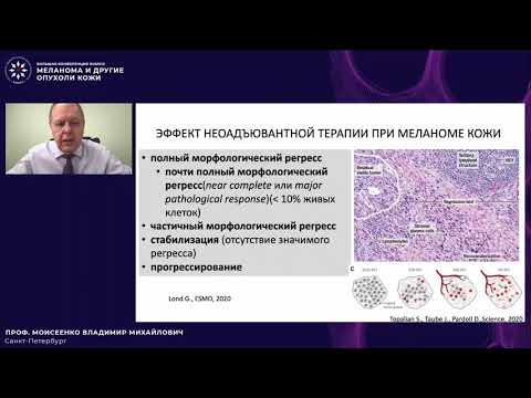 Видео: Неоадъювантная терапия резектабельной меланомы кожи. Есть ли место в клинической практике?
