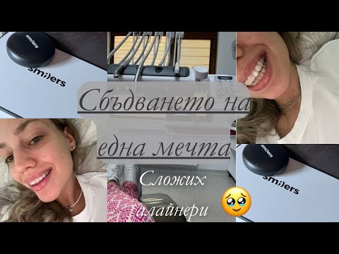 Видео: СЛОЖИХ АЛАЙНЕРИ- Първите 24 часа с тях🫣