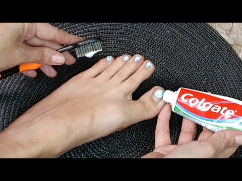 Видео: Жаль раньше об этом не знала ЗУБНОЙ ПАСТОЙ НОГТИ НЕ СПАСАЛА #совет