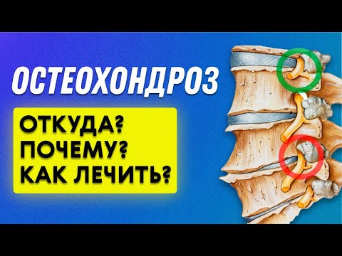 Видео: Остеохондроз причины | Остеопат Марина Просветина