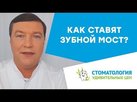 Видео: Как ставят зубной мост? Мост на задние и передние зубы.