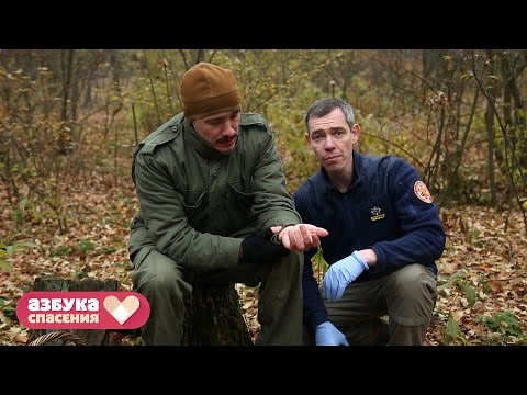 Видео: Азбука спасения. 20 серия. Укусы змей