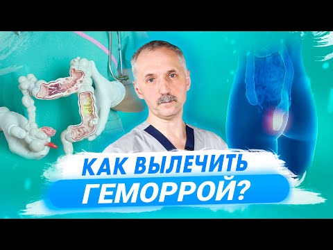 Видео: Как избавиться от геморроя: способы и рекомендации врача / Доктор Виктор
