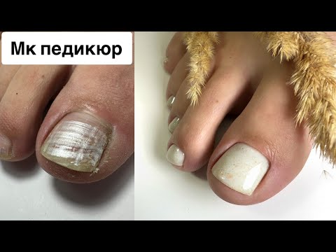 Видео: ПЕДИКЮР ОНЛАЙН. Виктория Авдеева