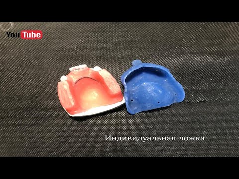Видео: Индивидуальная ложка зубного протеза | Individual tray prosthesis