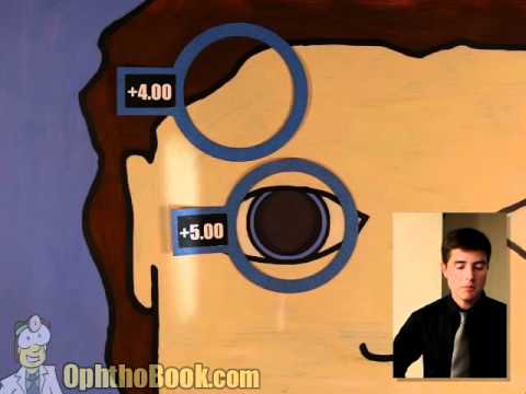 Видео: Офтальмология - Ретиноскопия (Часть 1/2)