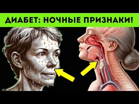 Видео: 7 ночных признаков Диабета, которые Вы Должны Знать! Диабет....