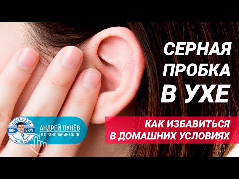 Видео: Серная пробка в ухе, как удалить самостоятельно