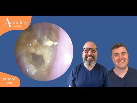 Видео: ДО И ПОСЛЕ ЛЕЧЕНИЯ ИНФЕКЦИИ УША - EP790